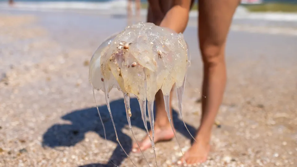 Como tratar uma queimadura de água-viva em crianças?