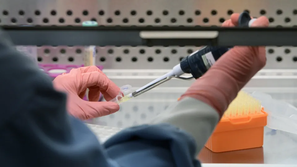 Estamos chegando perto da cura para o HIV? Esses são os progressos nas pesquisas