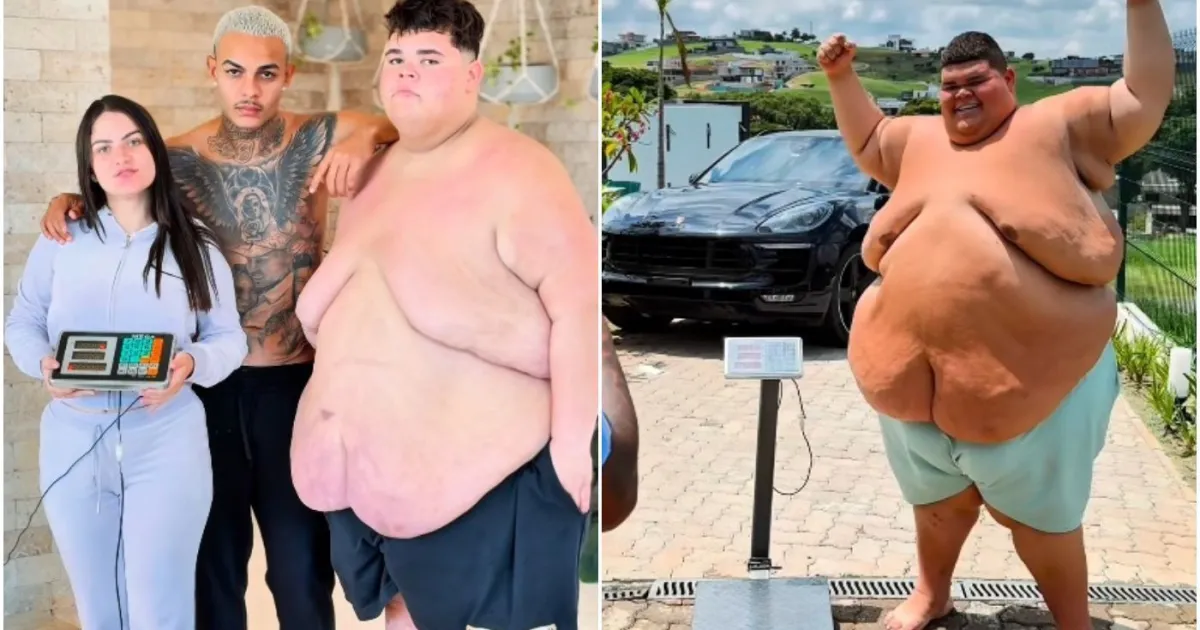 Após perder 130 kg, influenciador Gordão da XJ passa por cirurgia de risco