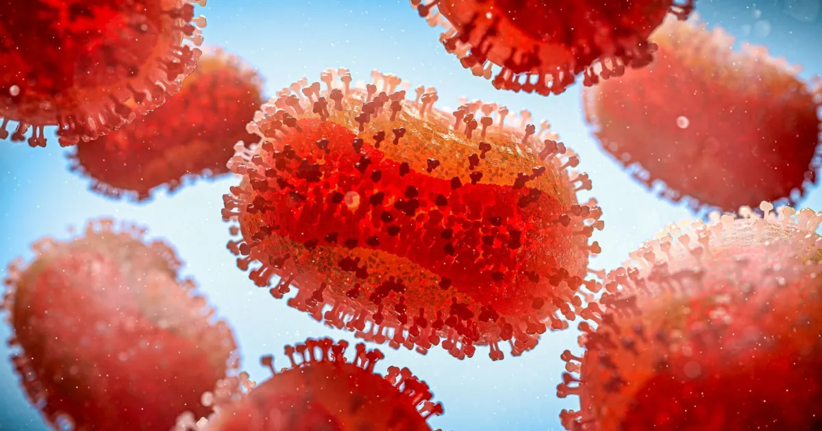 São Paulo registra segundo caso de nova cepa de Mpox no Brasil